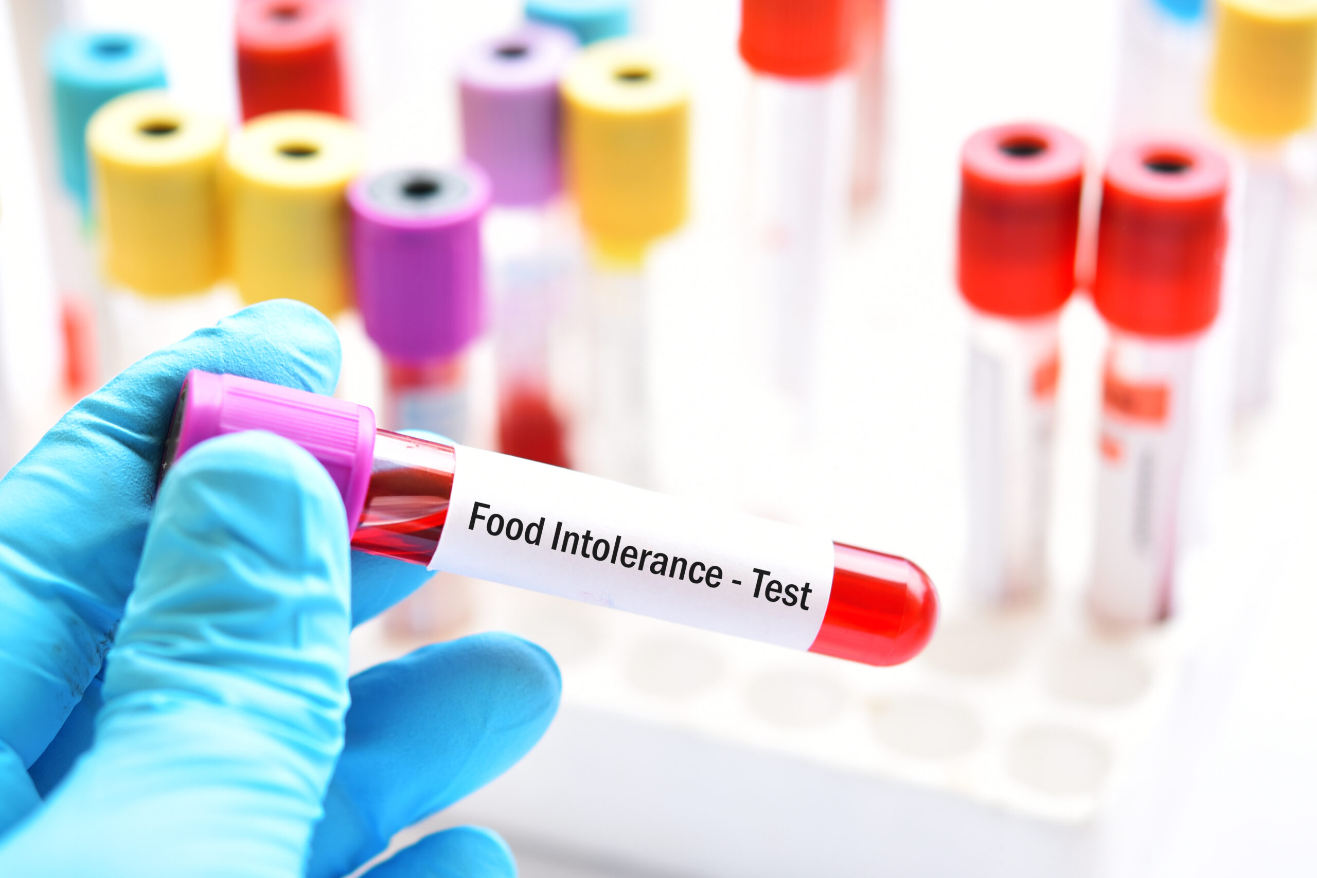 Blood Test in Dubai