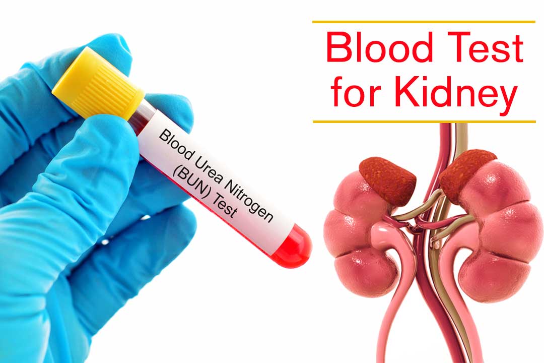 Blood Test in Dubai