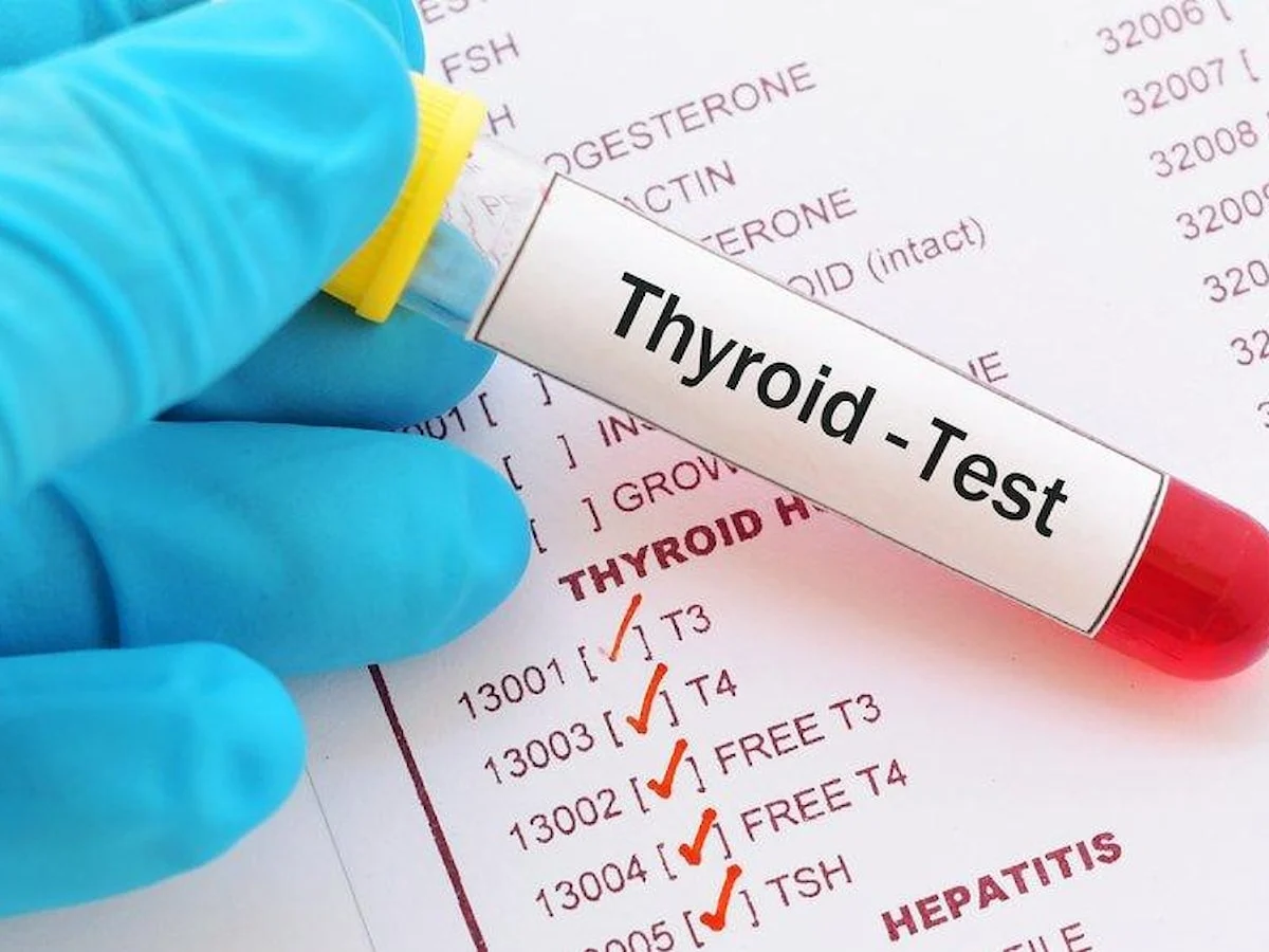 Blood Test in Dubai