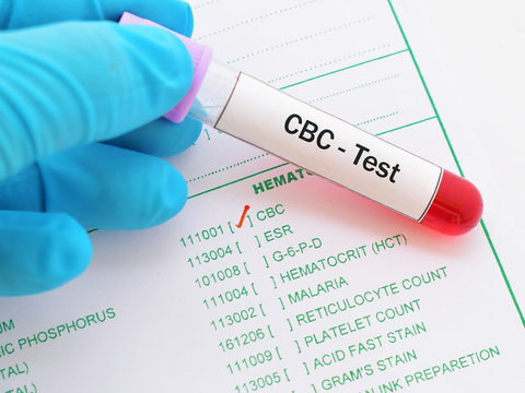 CBC test