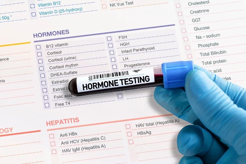 Hormone Test at Home