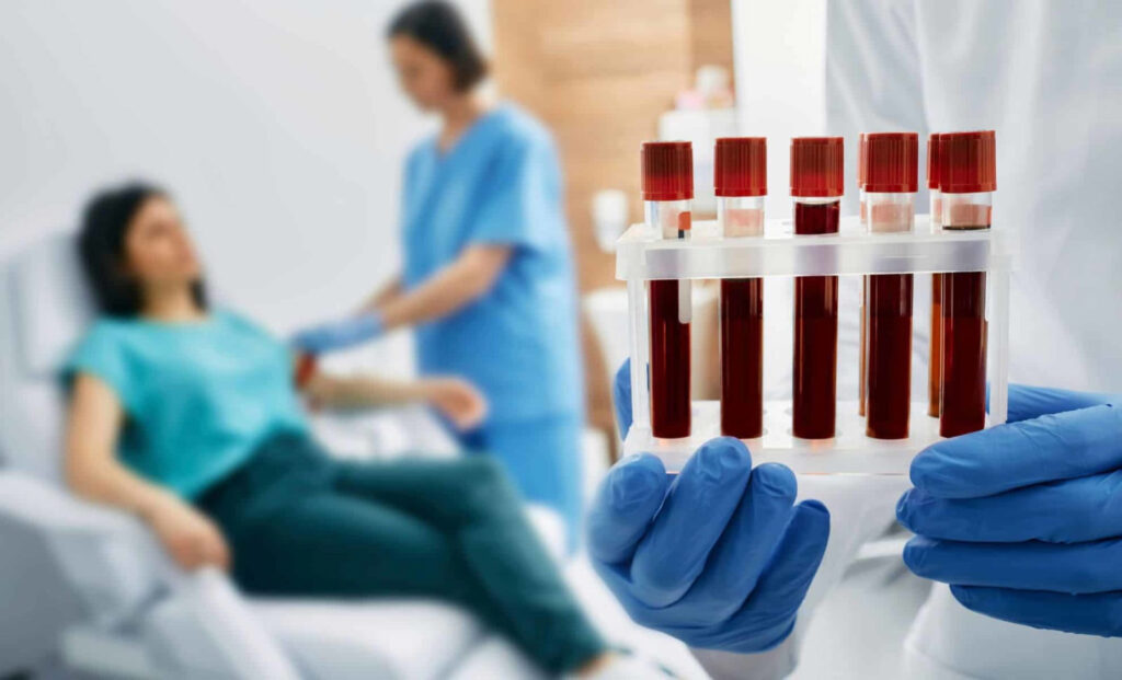 Blood Test in Dubai