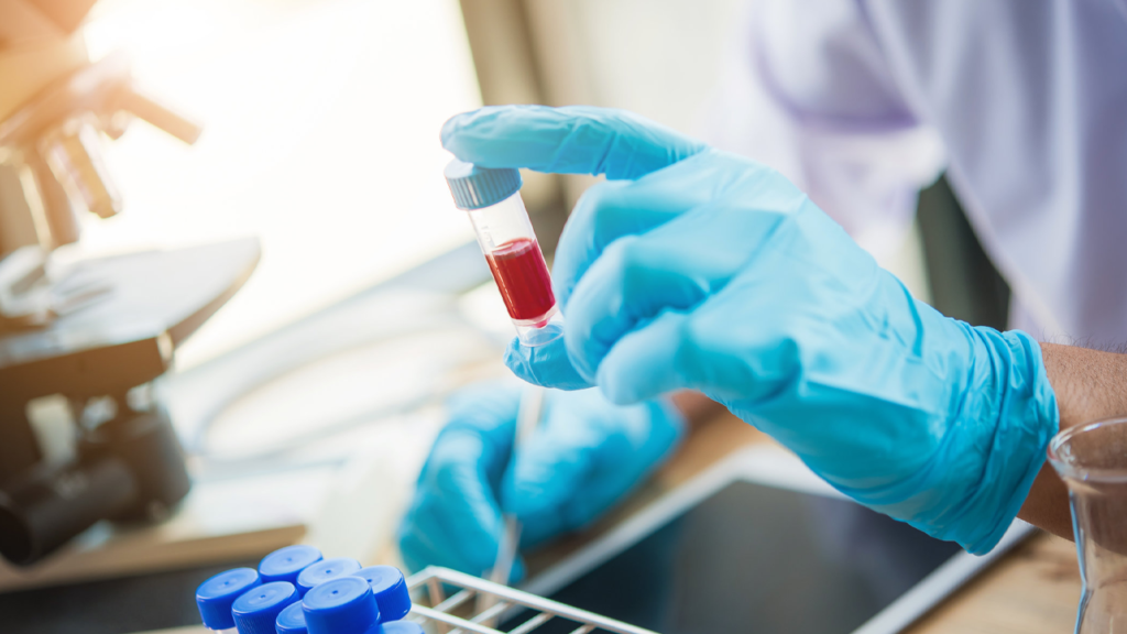blood test service