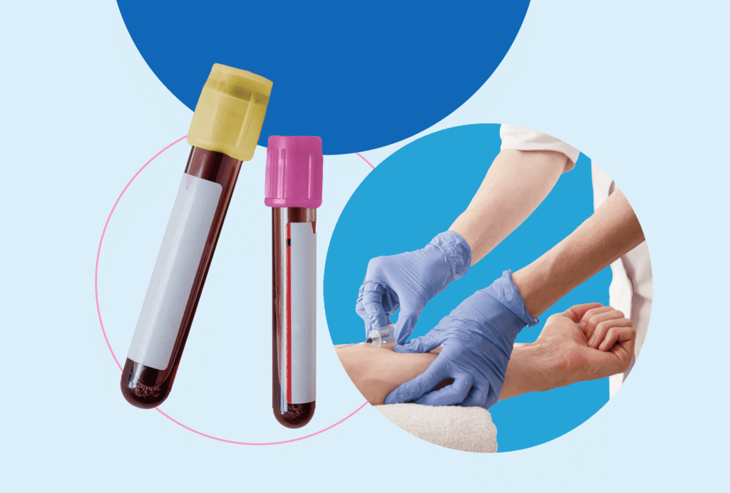 lab test at home in Dubai