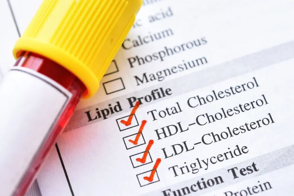 Blood Test in Dubai
