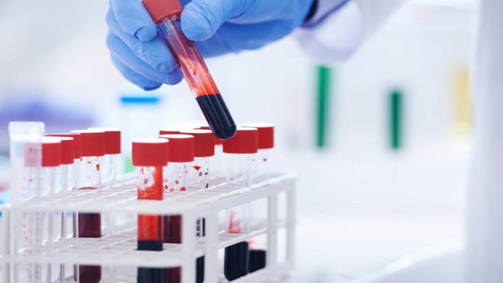 blood test in Dubai