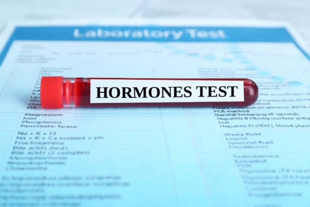 Blood Test in Dubai