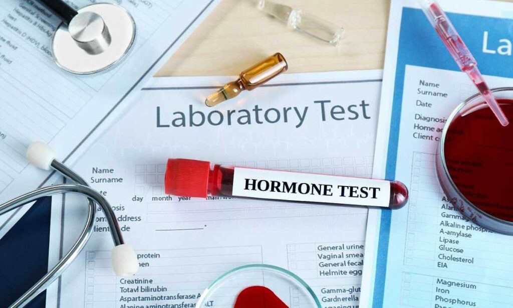 hormone test at home in Dubai