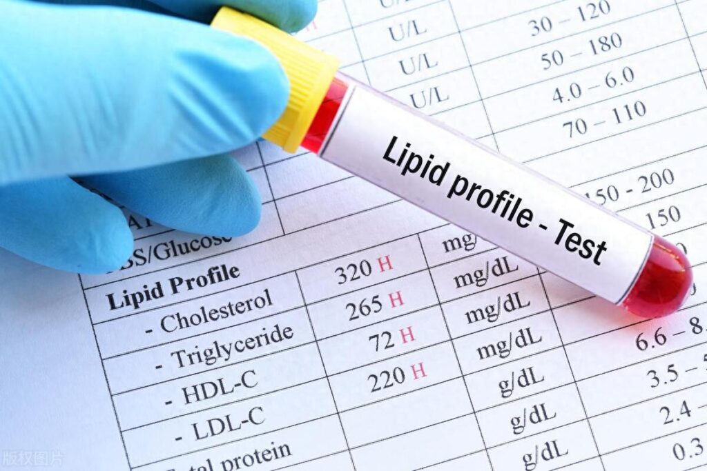 Blood Test in Dubai
