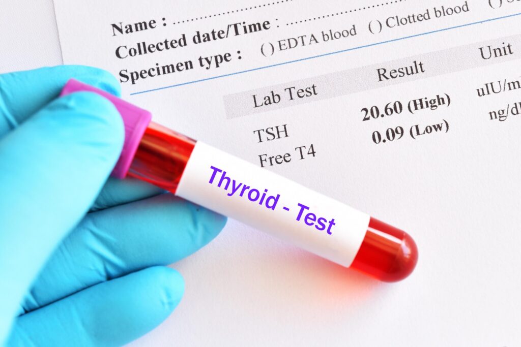 thyroid test in Dubai